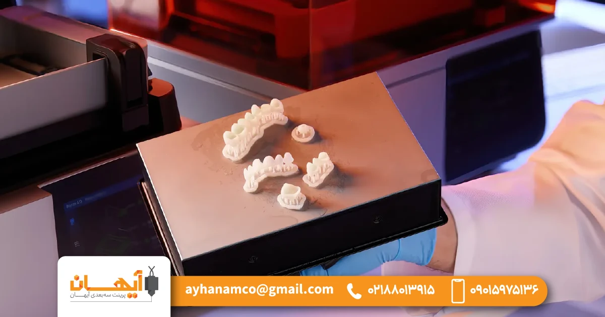 6) ساخت روکش و بریج به صورت پرینت سه بعدی