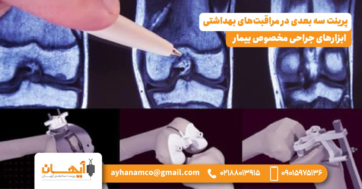 2. ابزارهای جراحی مخصوص بیمار (Patient-Specific Surgical Instruments) 2. ابزارهای جراحی مخصوص بیمار (Patient-Specific Surgical Instruments)