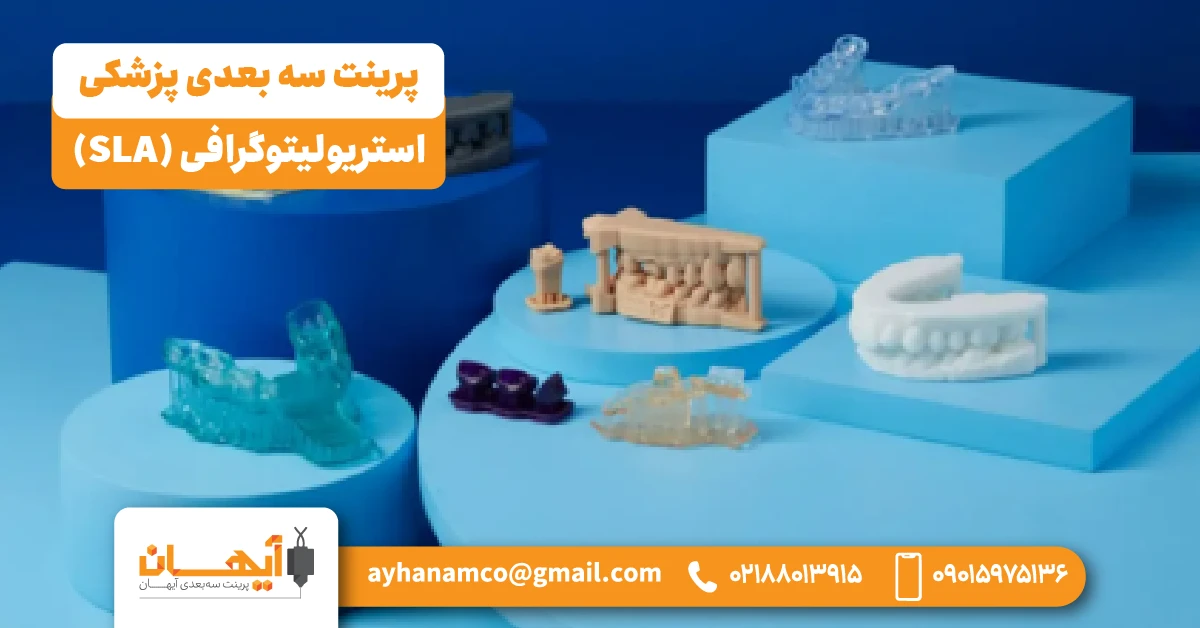 ⫸ استریولیتوگرافی (SLA) ⫸ استریولیتوگرافی (SLA)