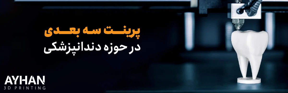 پرینت سه بعدی در حوزه دندانپزشکی | تحولی نو در ساخت دندان